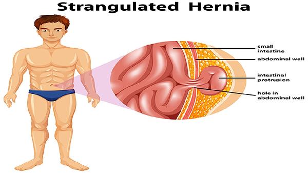 红烧兔子肉家常做法是怎样的？